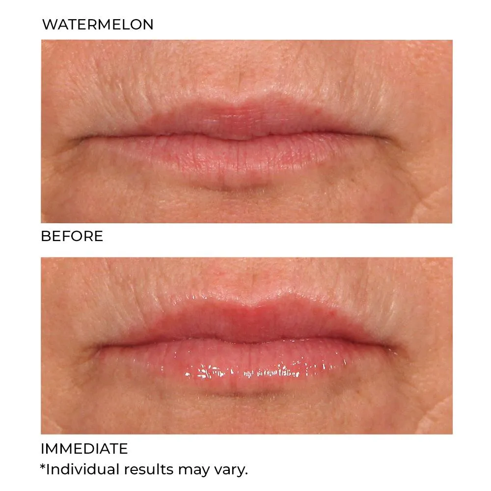 Hydro-Screen Lip Plumper - Watermelon