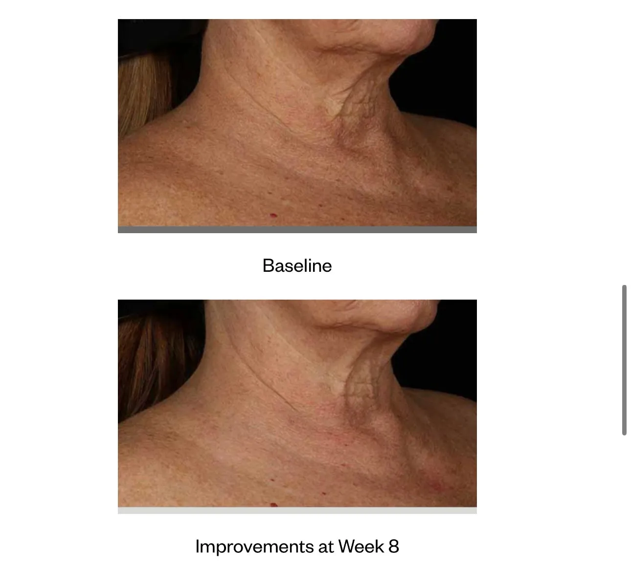 Neck Correct Cream