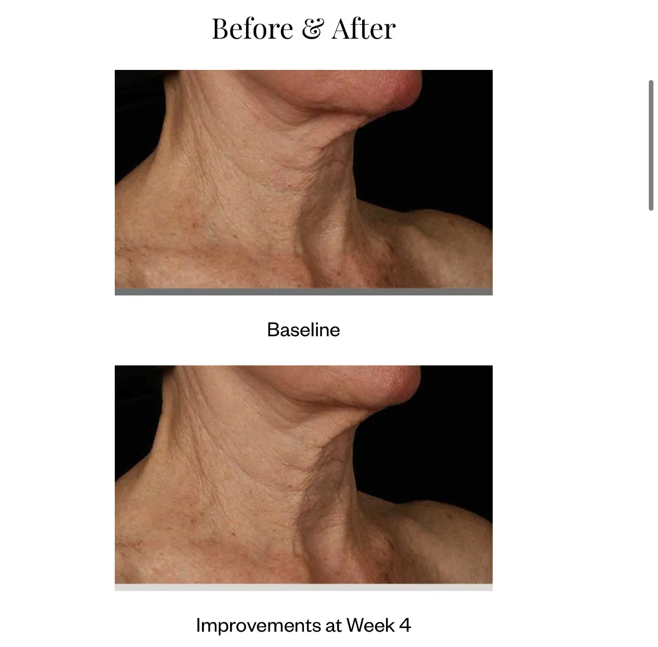 Neck Correct Cream