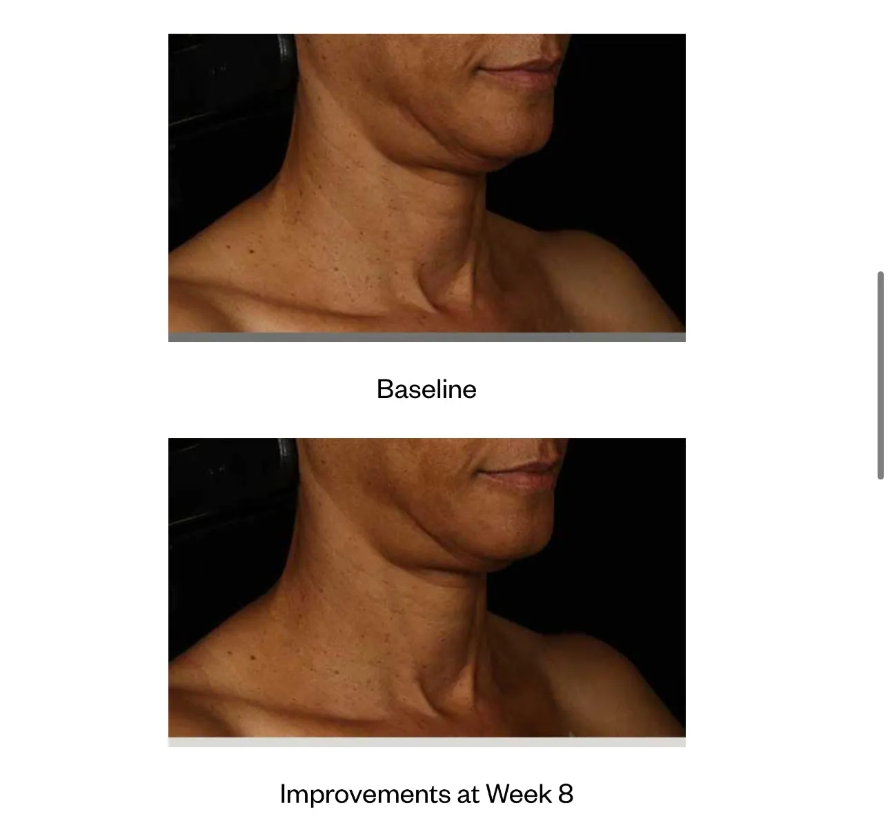 Neck Correct Cream