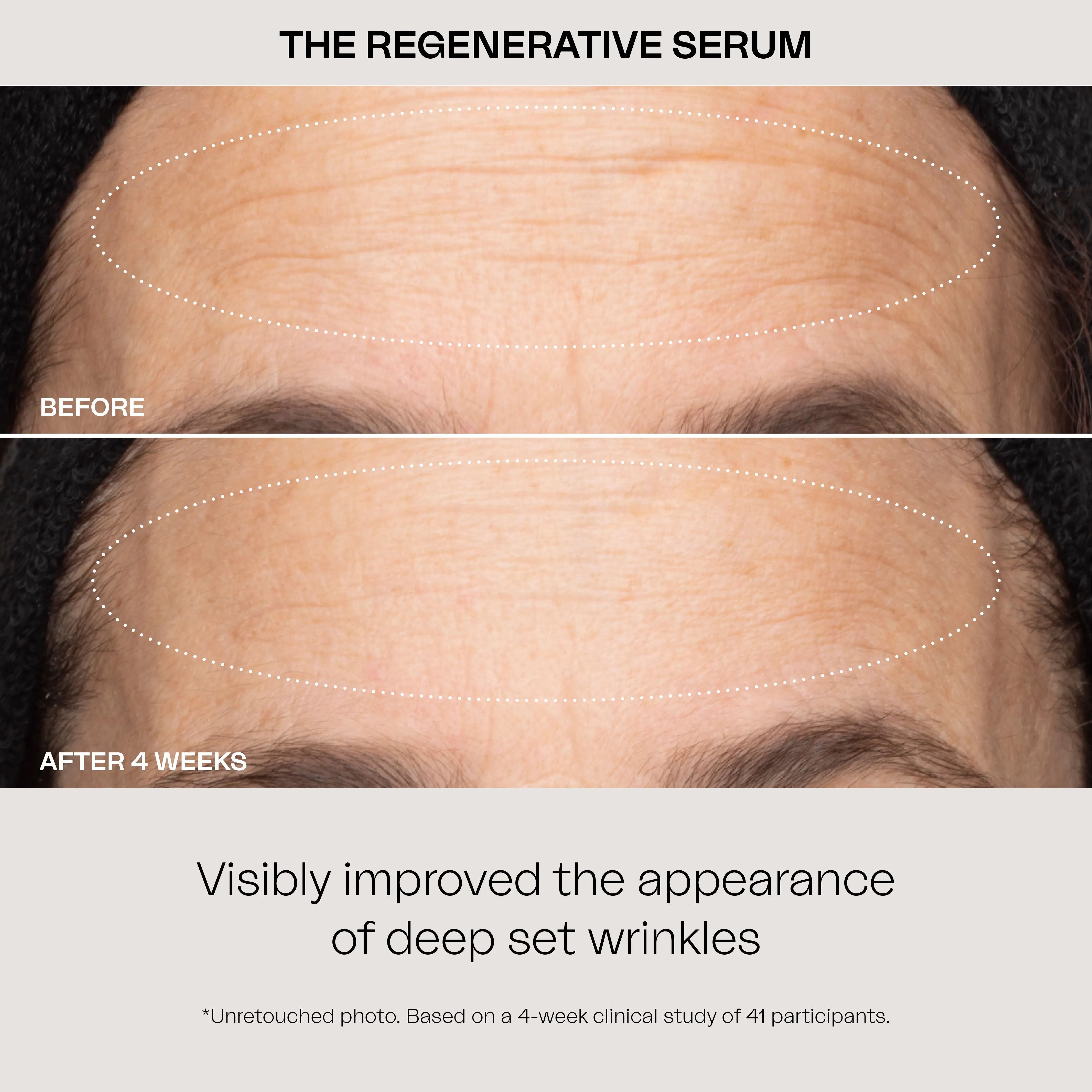 The Regenerative Serum